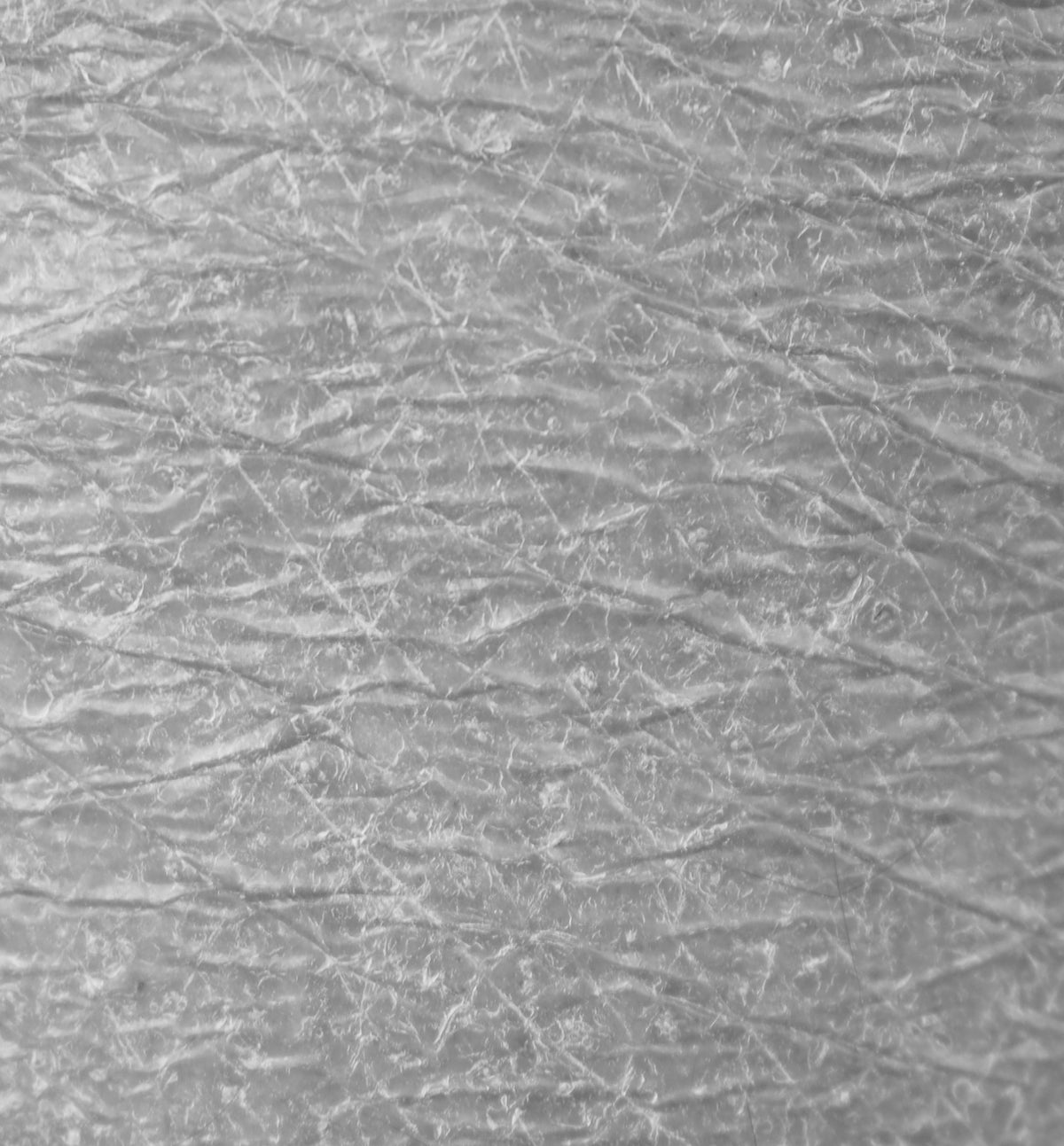 Dry, scaly skin
