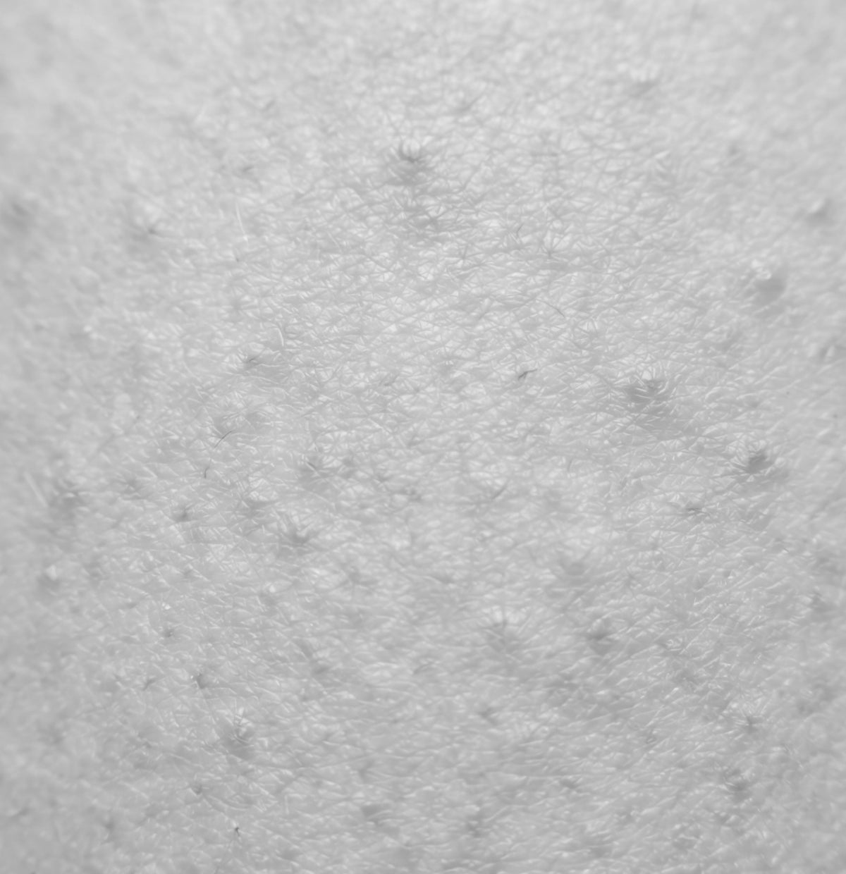Rough, bumpy skin
