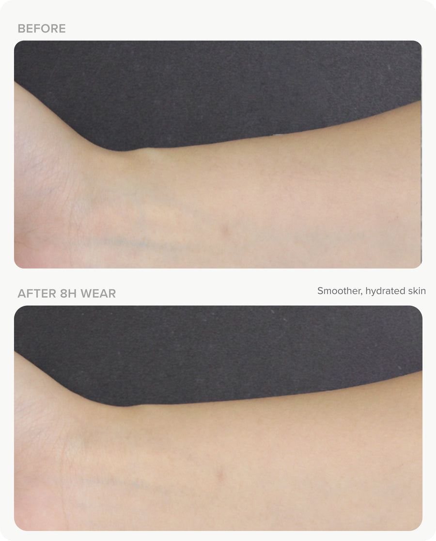 Clinical Results